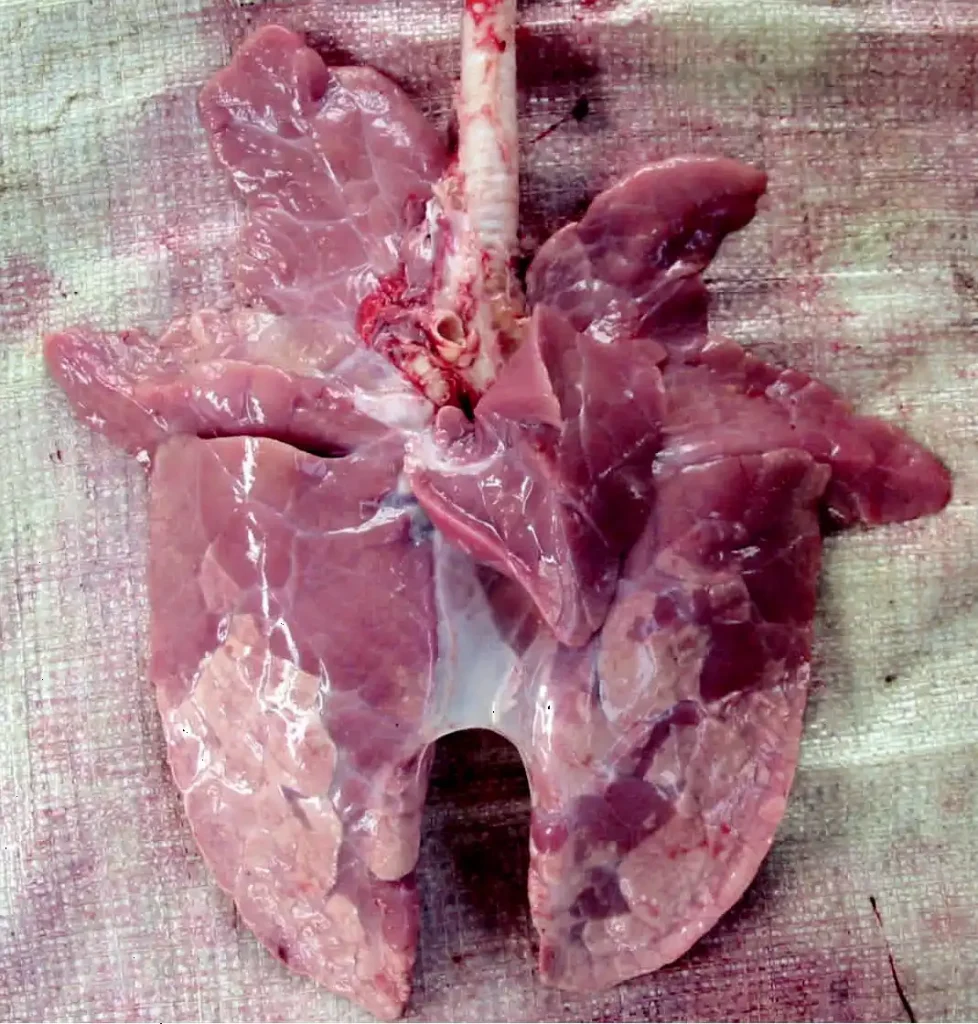 Viêm phổi đối xứng