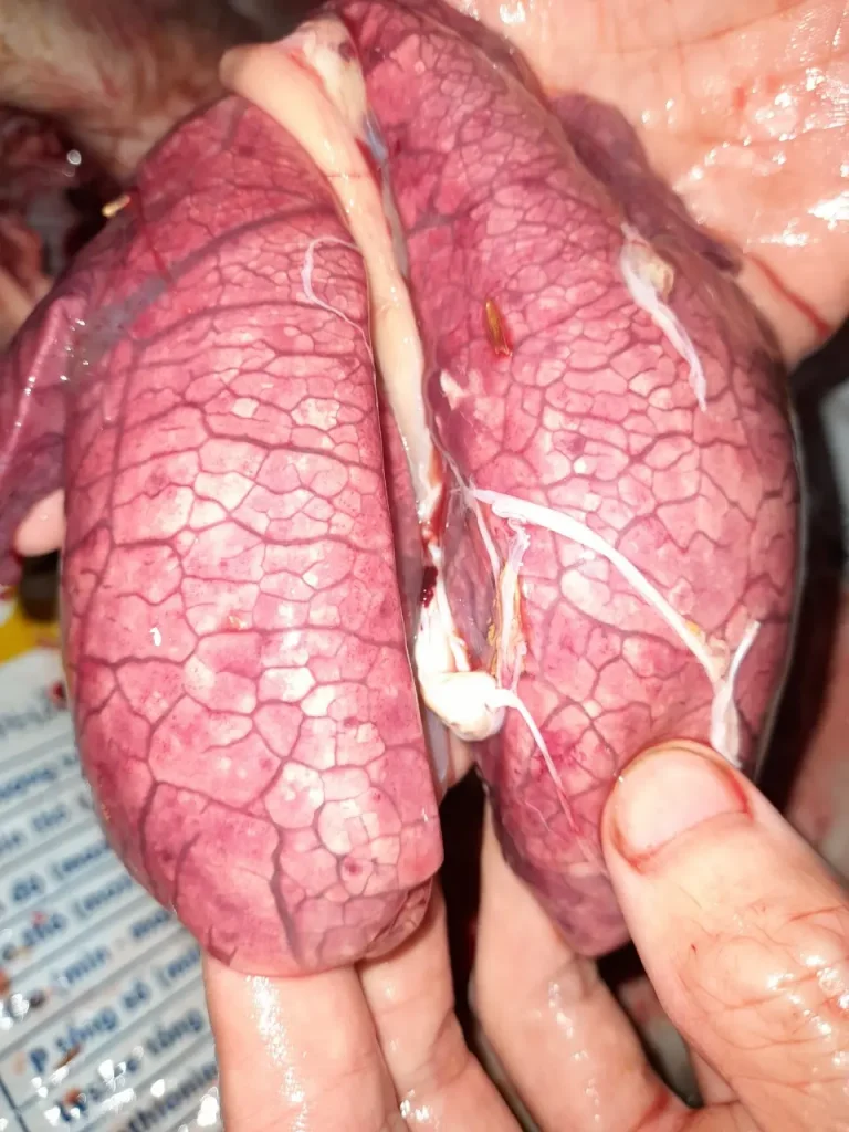 Viêm phổi kẽ
