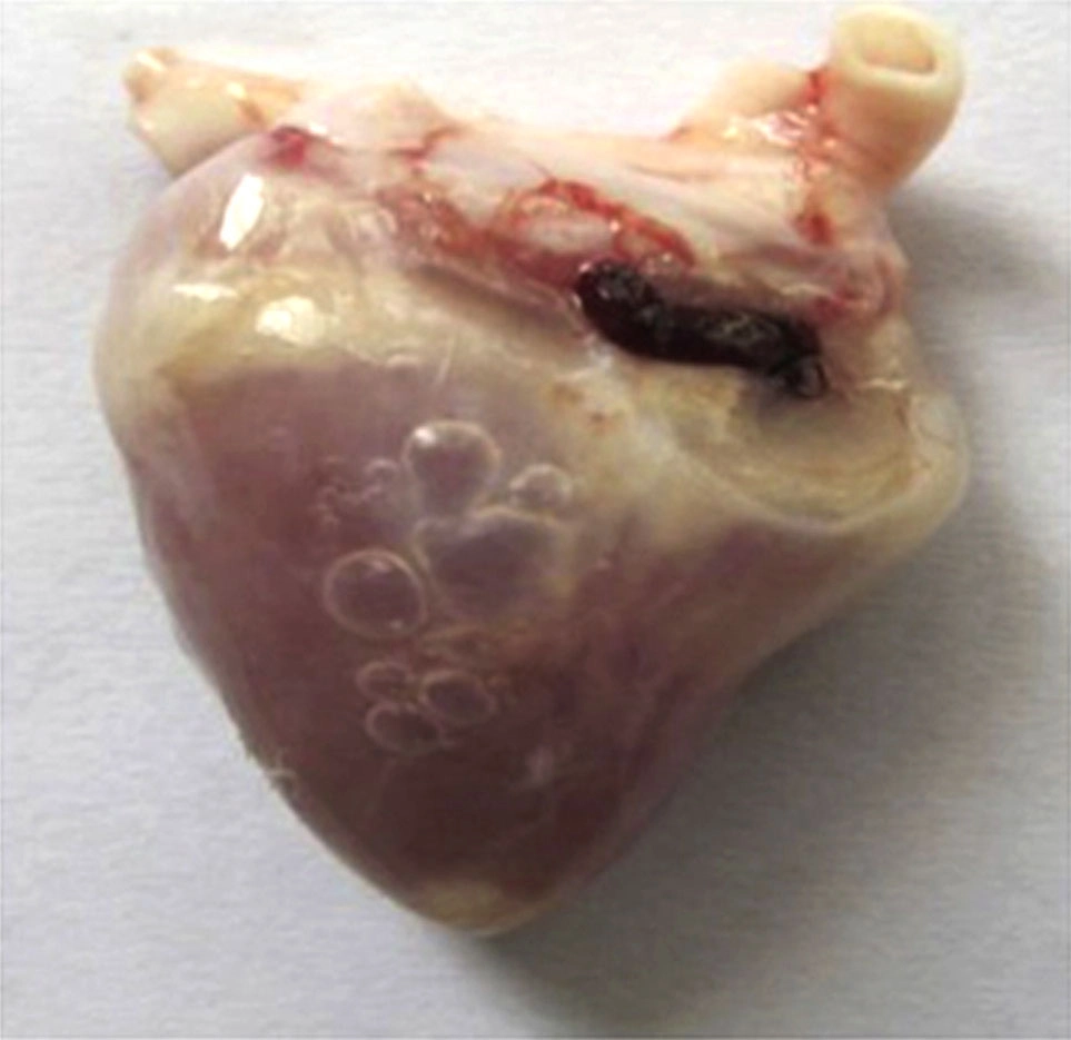 Bệnh Adeno trên vịt tim biến dạng