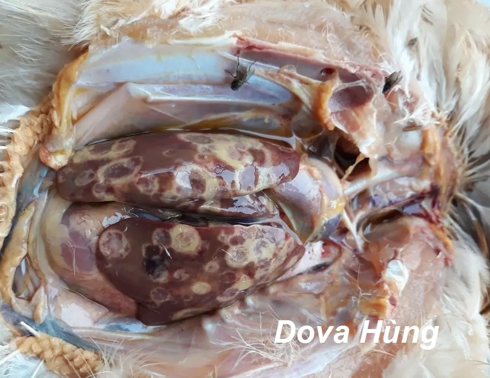Gan gà bị hoại tử lõm xuống