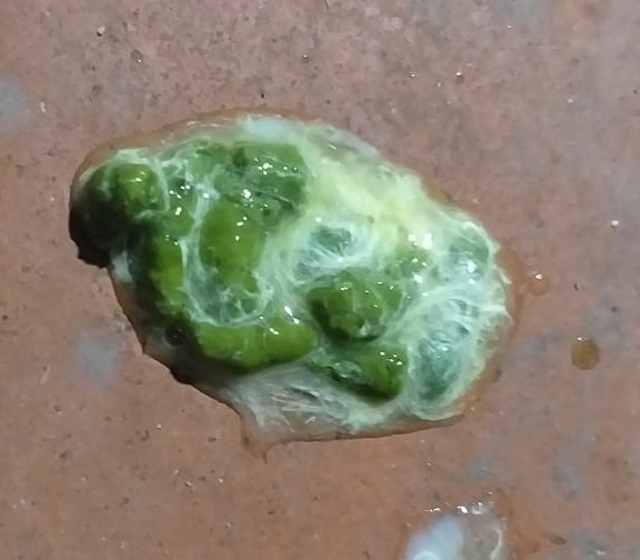 Ký sinh trùng máu phân gà có màu xanh nõn chuối