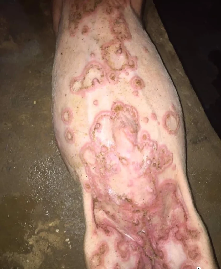 Lợn bị viêm da do Streptococcus