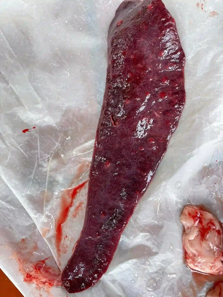 Phó thương hàn ở lợn lách nhồi huyết