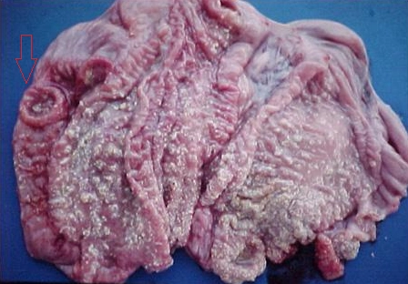 Phó thương hàn lợn ruột già loét hình cúc áo