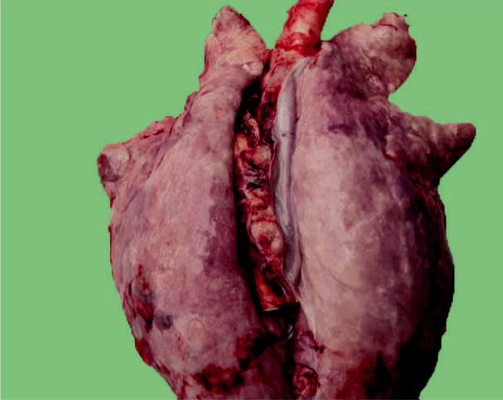 Bệnh tụ huyết trùng lợn gây viêm màng phổi, phổi xuất huyết